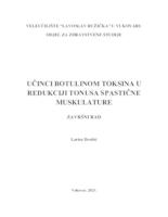 UČINCI BOTULINUM TOKSINA U REDUKCIJI TONUSA SPASTIČNE MUSKULATURE